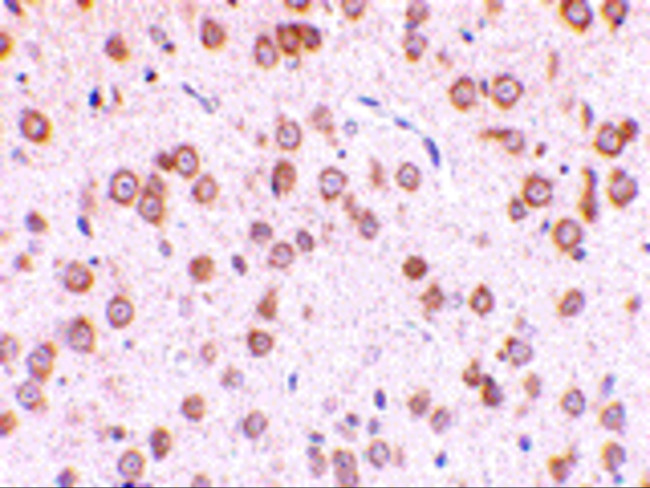 TLR5 Antibody in Immunohistochemistry (IHC)