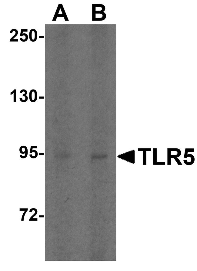 TLR5 Antibody in Western Blot (WB)