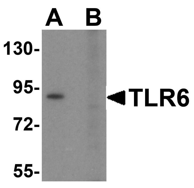 TLR6 Antibody in Western Blot (WB)