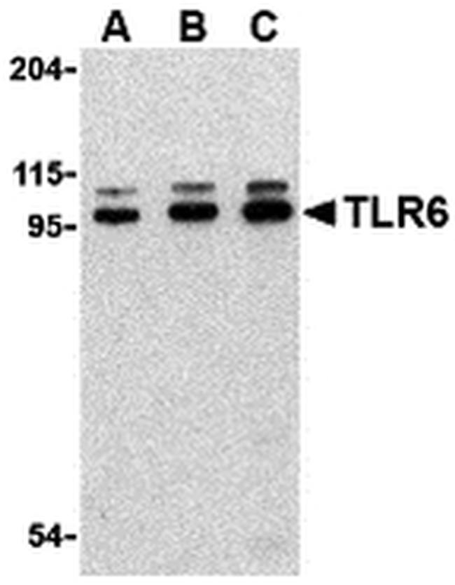 TLR6 Antibody in Western Blot (WB)