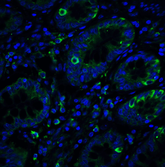 IRE1 alpha Antibody in Immunohistochemistry (PFA fixed) (IHC (PFA))