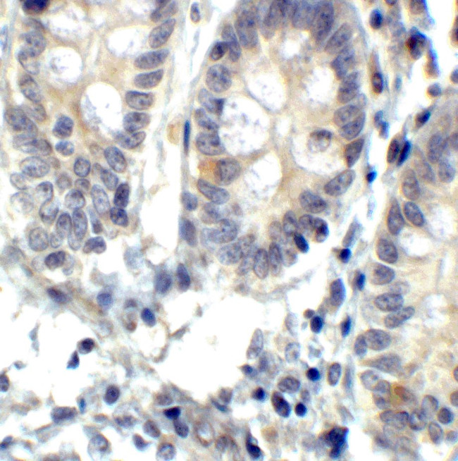 IRE1 alpha Antibody in Immunohistochemistry (Paraffin) (IHC (P))