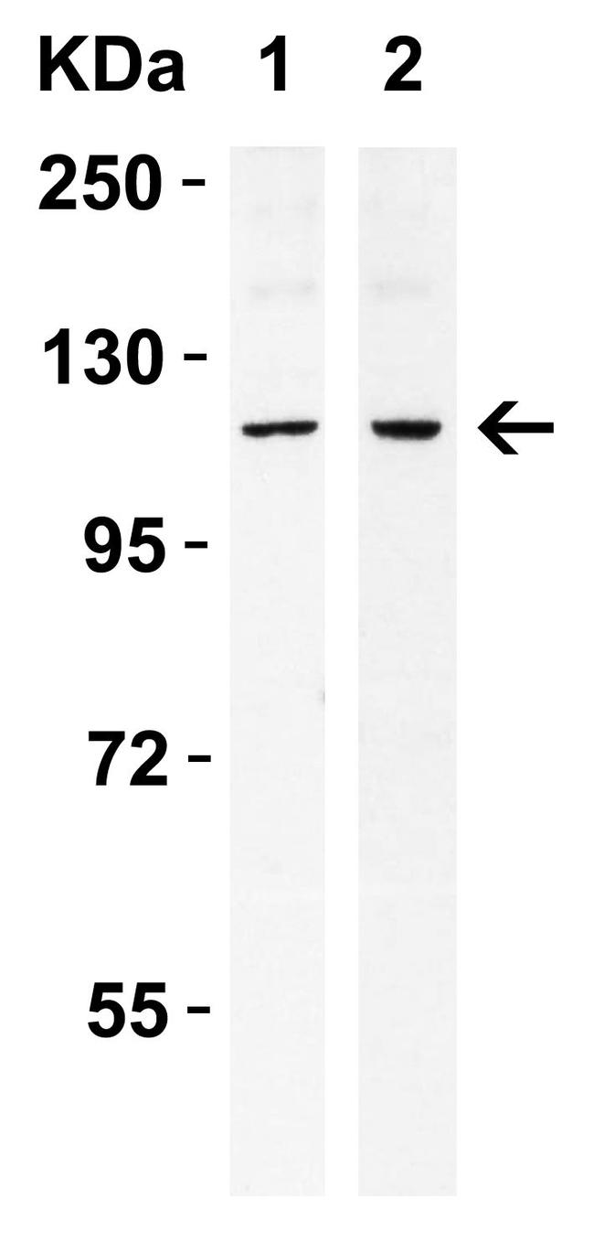 IRE1 alpha Antibody in Western Blot (WB)