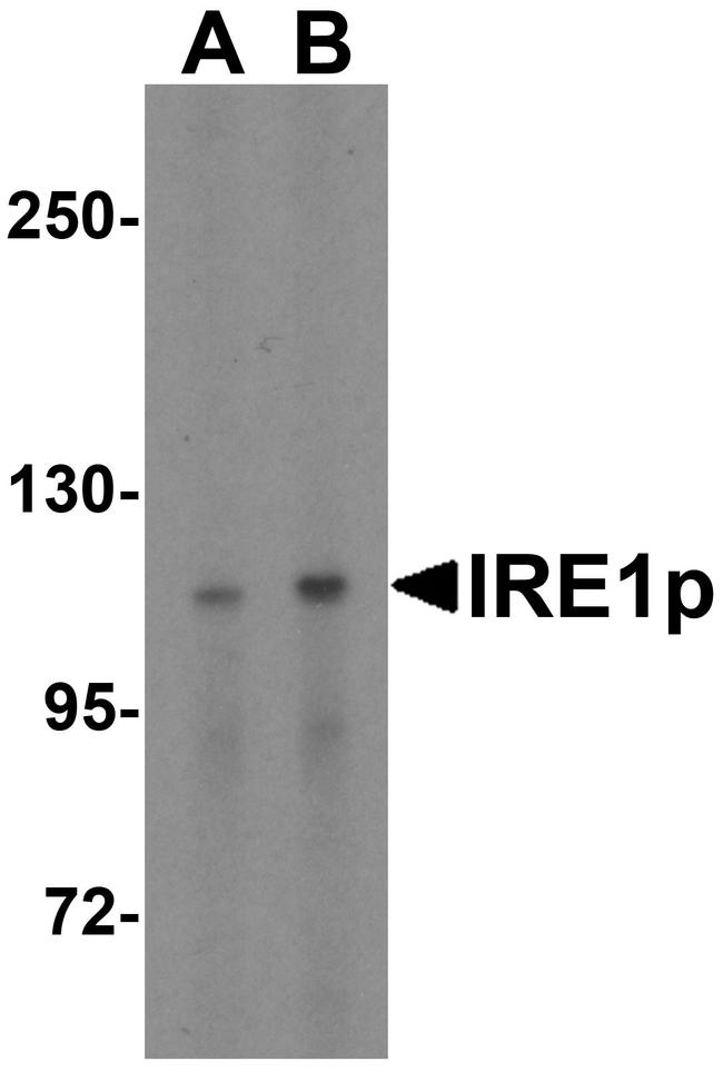 IRE1 alpha Antibody in Western Blot (WB)