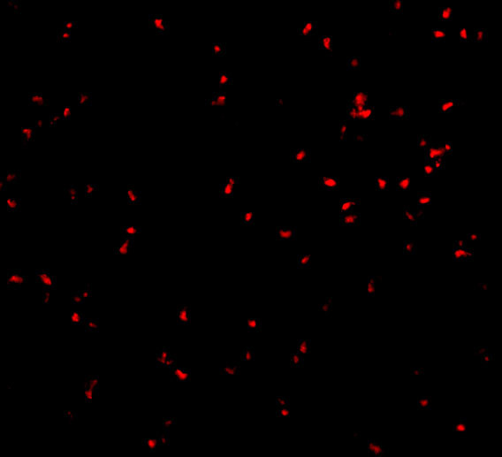 IRE1 alpha Antibody in Immunocytochemistry (ICC/IF)