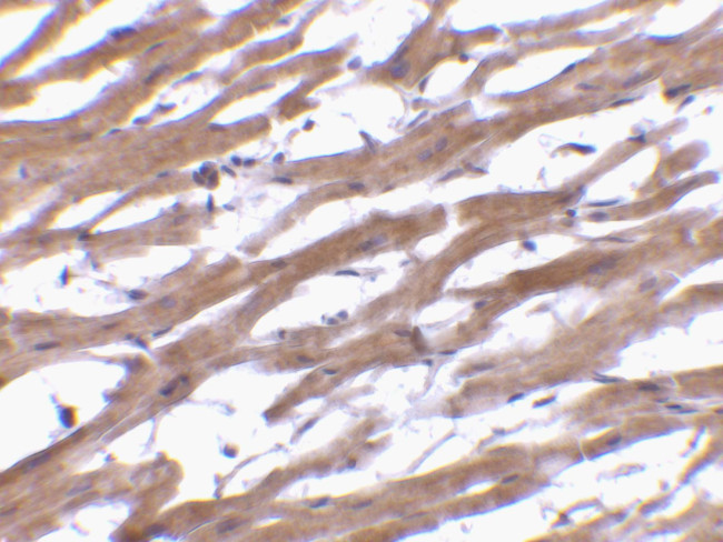 BAP29 Antibody in Immunohistochemistry (IHC)