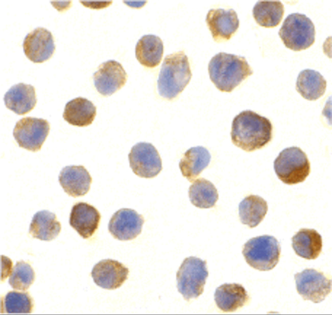 CTRP2 Antibody in Immunocytochemistry (ICC/IF)