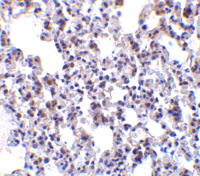 BAP31 Antibody in Immunohistochemistry (Paraffin) (IHC (P))