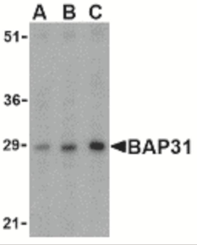 BAP31 Antibody in Western Blot (WB)