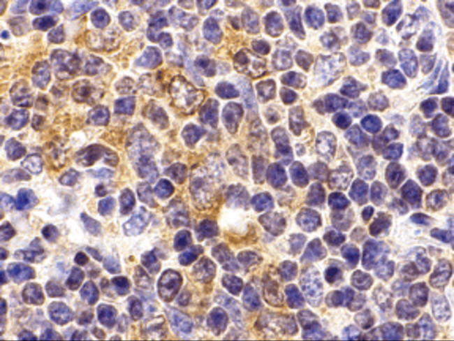 TLR9 Antibody in Immunohistochemistry (IHC)