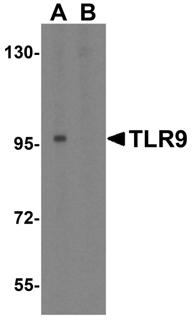 TLR9 Antibody in Western Blot (WB)