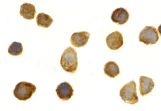 TOLLIP Antibody in Immunocytochemistry (ICC/IF)