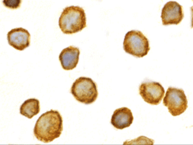 TOLLIP Antibody in Immunocytochemistry (ICC/IF)