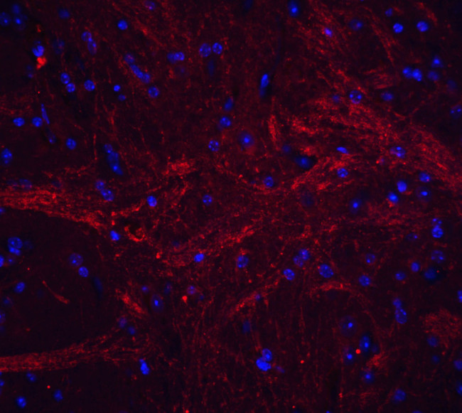 TWEAK Antibody in Immunohistochemistry (PFA fixed) (IHC (PFA))