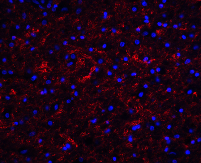 Apolipoprotein J Antibody in Immunohistochemistry (IHC)