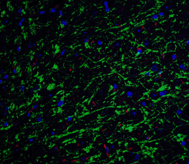 Apolipoprotein J Antibody in Immunohistochemistry (IHC)