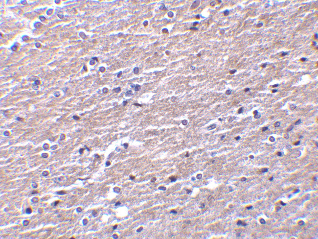 Apolipoprotein J Antibody in Immunohistochemistry (IHC)