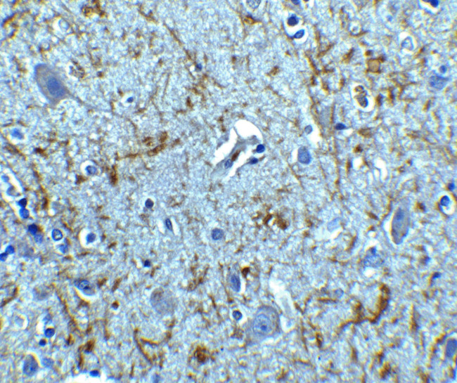 Apolipoprotein J Antibody in Immunohistochemistry (IHC)