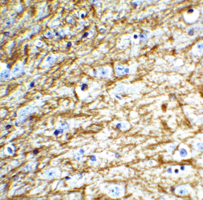 Apolipoprotein J Antibody in Immunohistochemistry (IHC)