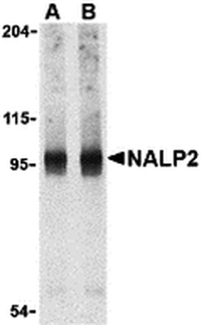 NALP2 Antibody in Western Blot (WB)