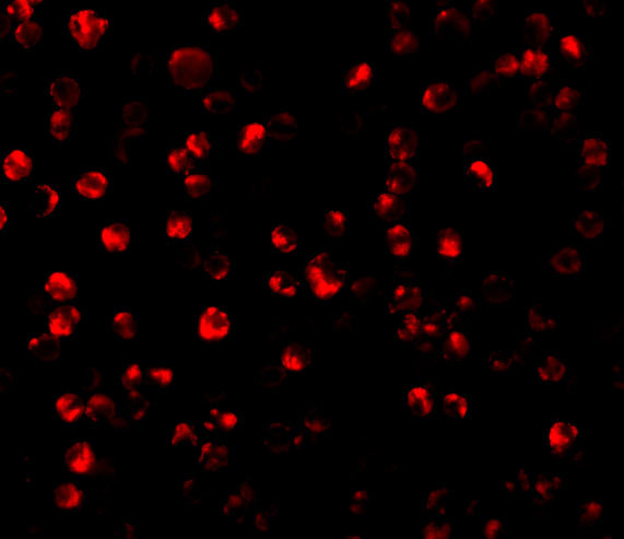 ATF6 Antibody in Immunocytochemistry (ICC/IF)