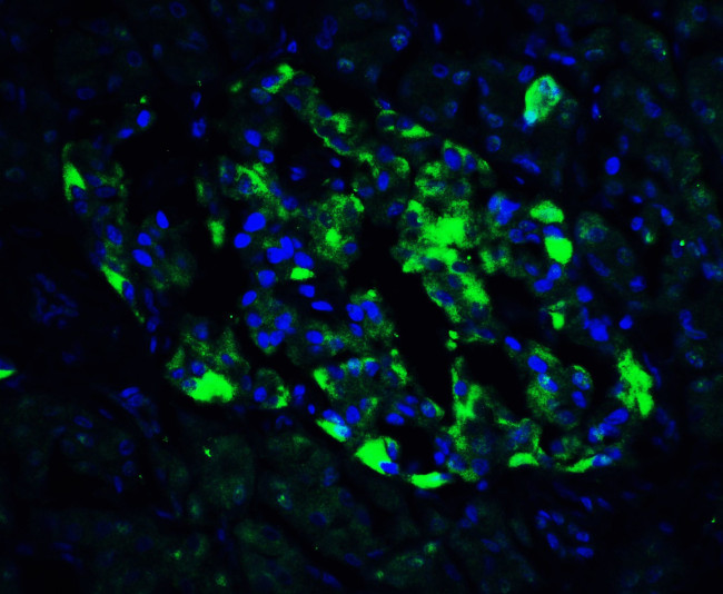 ATF6 Antibody in Immunohistochemistry (IHC)