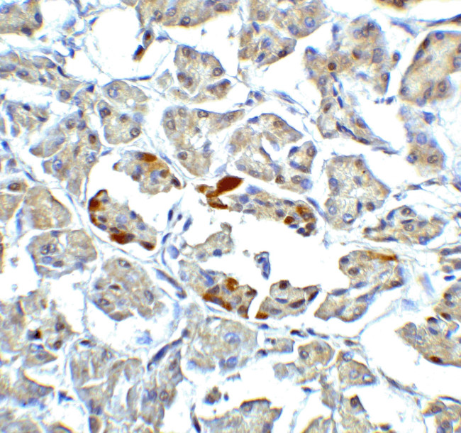 ATF6 Antibody in Immunohistochemistry (IHC)