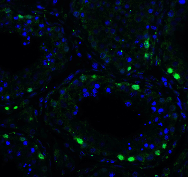 ATF6 Antibody in Immunocytochemistry (ICC/IF)