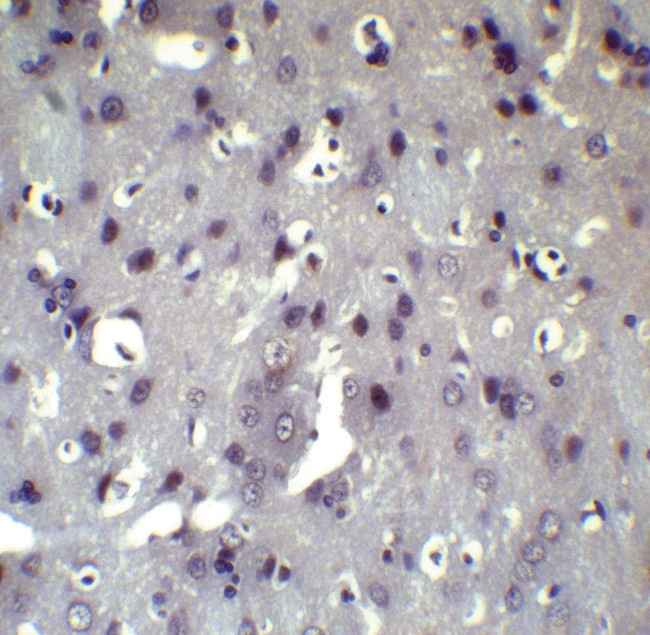 ATF6 Antibody in Immunohistochemistry (Paraffin) (IHC (P))