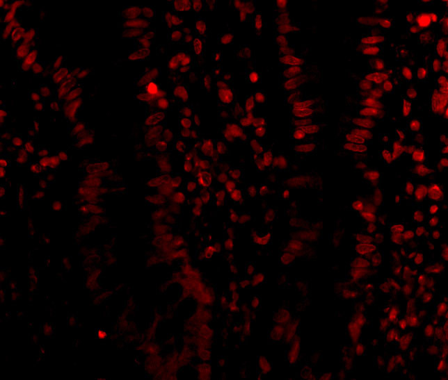 LSD1 Antibody in Immunocytochemistry (ICC/IF)