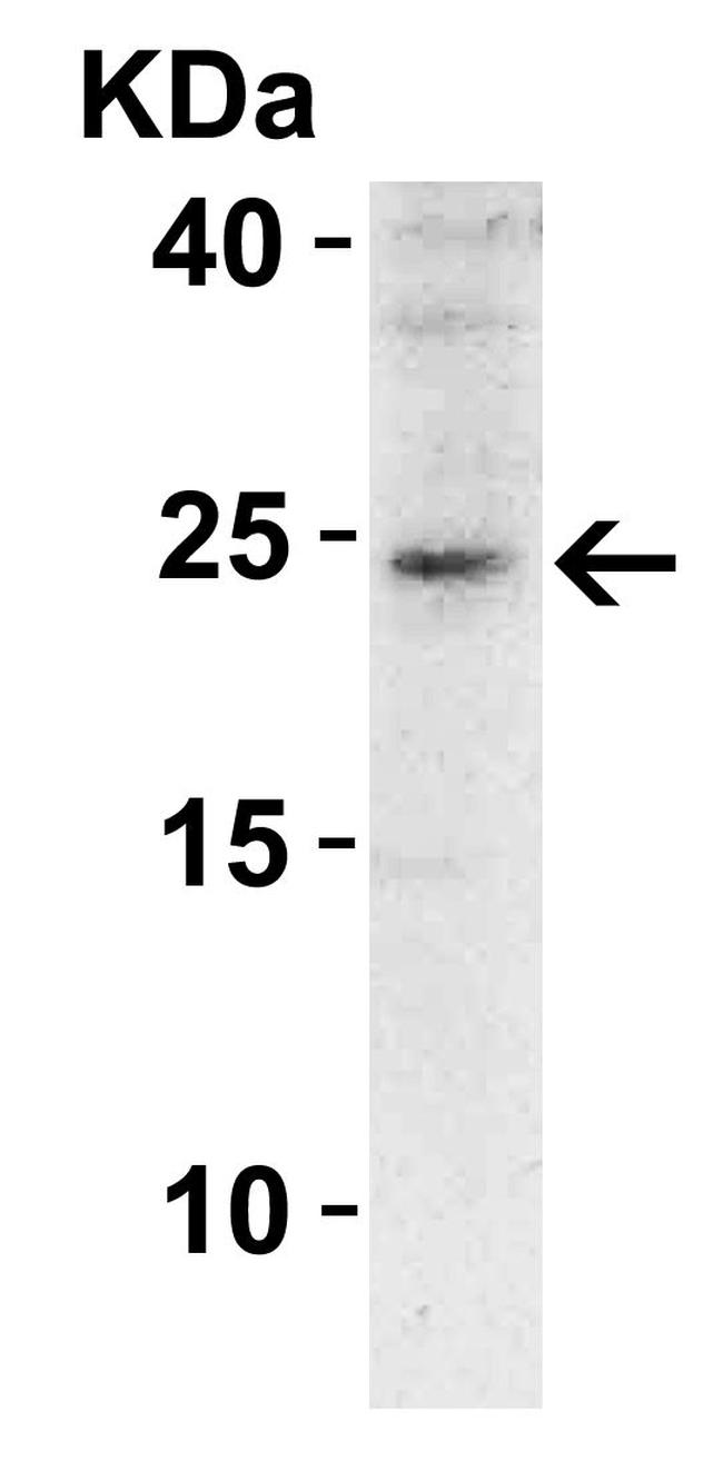 SOCS1 Antibody in Western Blot (WB)