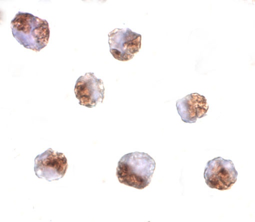 PAK6 Antibody in Immunocytochemistry (ICC/IF)