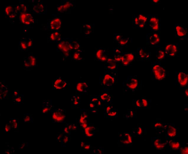 PAK7 Antibody in Immunocytochemistry (ICC/IF)