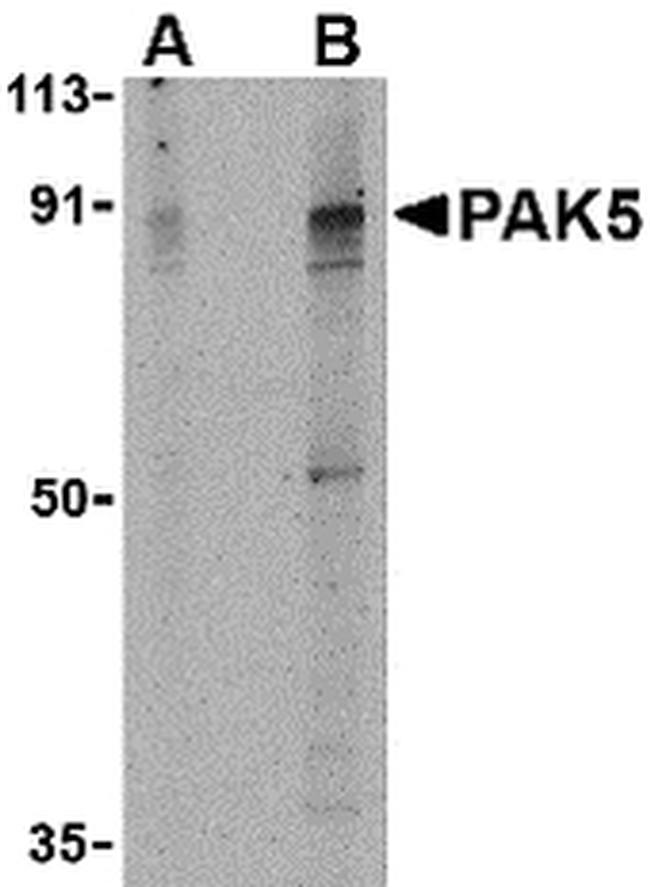 PAK7 Antibody in Western Blot (WB)