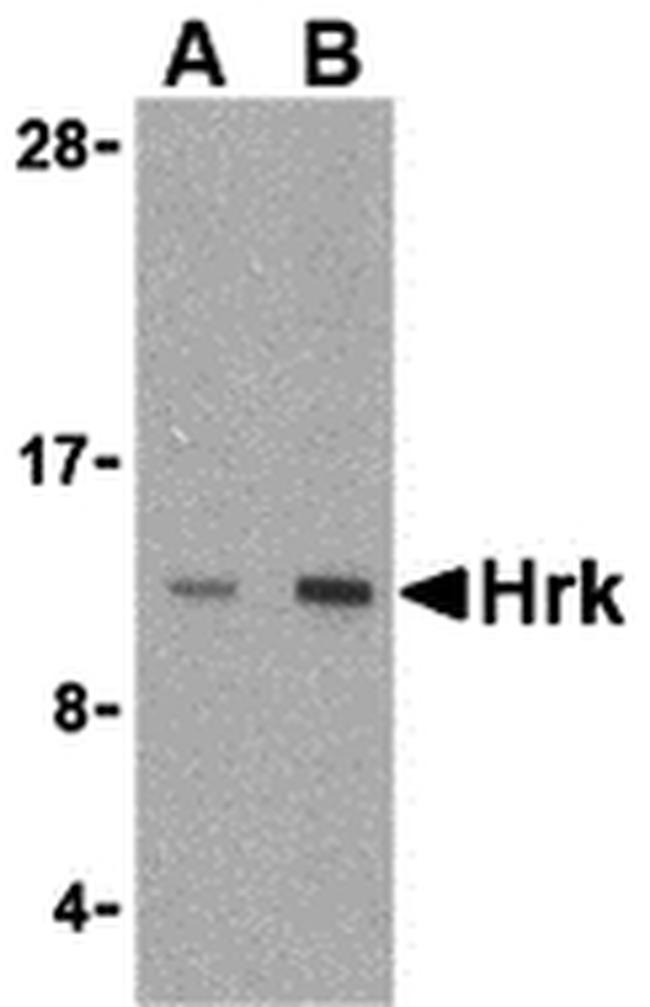 HRK Antibody in Western Blot (WB)