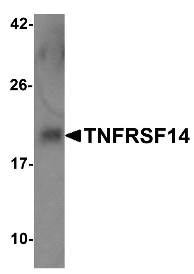 TNFRSF14 Antibody in Western Blot (WB)