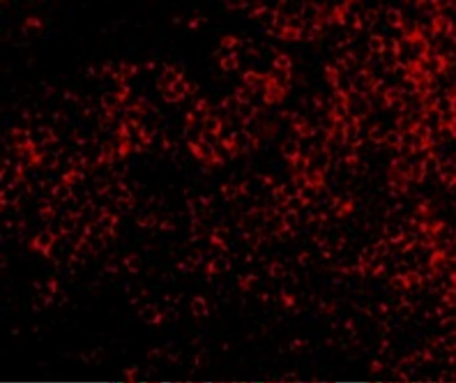 TNFRSF14 Antibody in Immunohistochemistry (IHC)