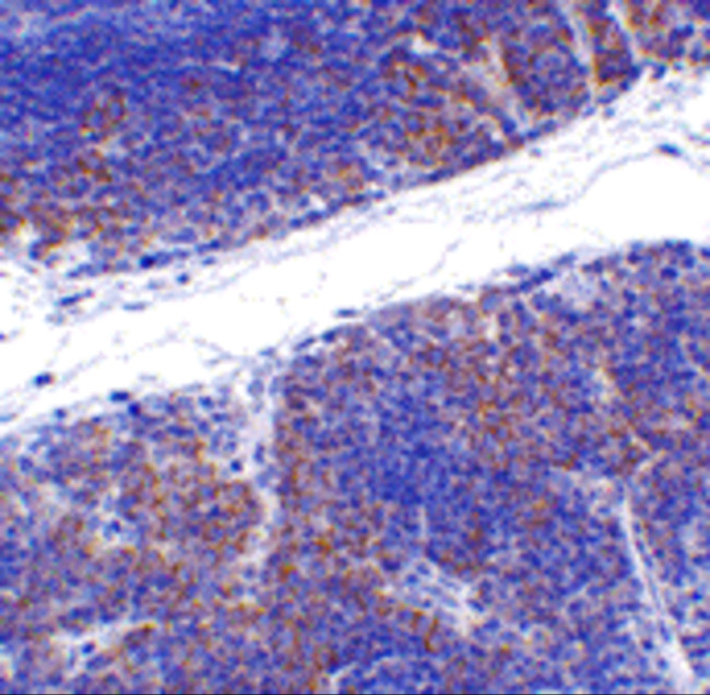 TNFRSF14 Antibody in Immunohistochemistry (IHC)