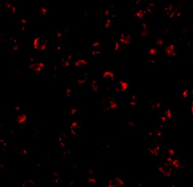 IL-23 p19 Antibody in Immunocytochemistry (ICC/IF)