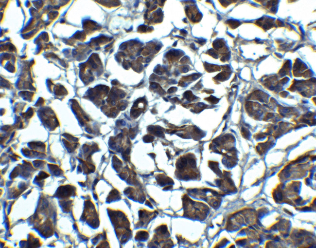 IL-23 p19 Antibody in Immunohistochemistry (Paraffin) (IHC (P))