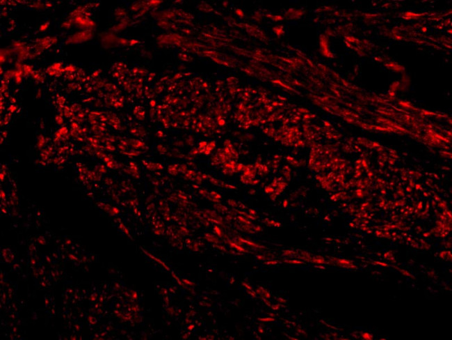 TIM-1 Antibody in Immunocytochemistry (ICC/IF)