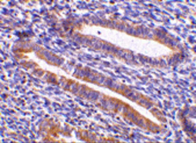 TIM-1 Antibody in Immunohistochemistry (Paraffin) (IHC (P))