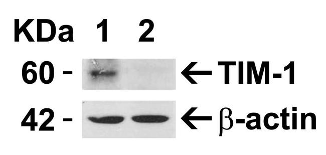 TIM-1 Antibody in Western Blot (WB)