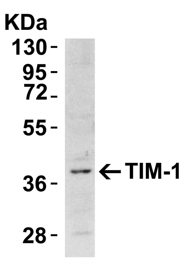 TIM-1 Antibody in Western Blot (WB)