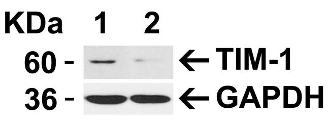 TIM-1 Antibody in Western Blot (WB)