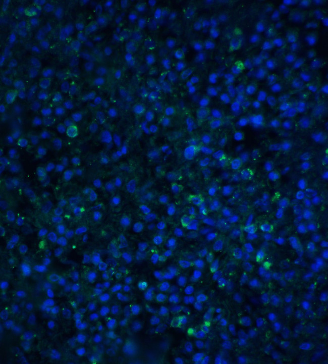 TIMD4 Antibody in Immunohistochemistry (IHC)