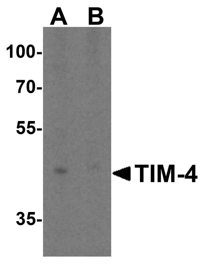 TIMD4 Antibody in Western Blot (WB)