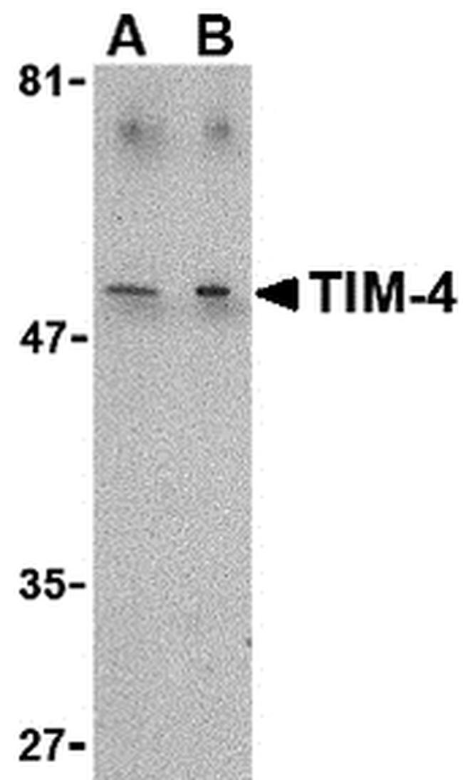 TIMD4 Antibody in Western Blot (WB)