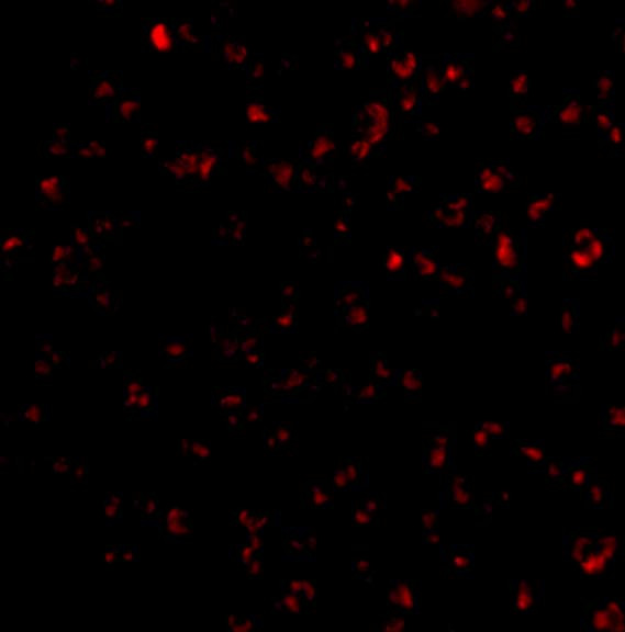 BIK Antibody in Immunocytochemistry (ICC/IF)