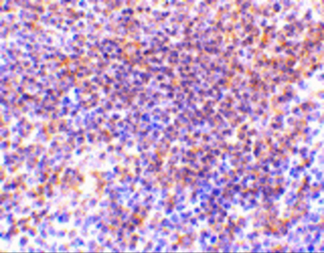 PAK2 Antibody in Immunohistochemistry (Paraffin) (IHC (P))